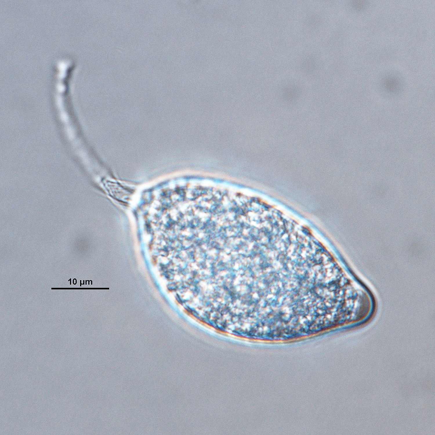   Phytophthora tropicalisnbsp; asexual phase of ex-type CPHST BL 58 formed on V8 agar flooded with soil extract: sporangiumnbsp;papillate, caducous with long pedicel; photonbsp;by Gloria Abad, USDA-APHIS-PPQ. 
